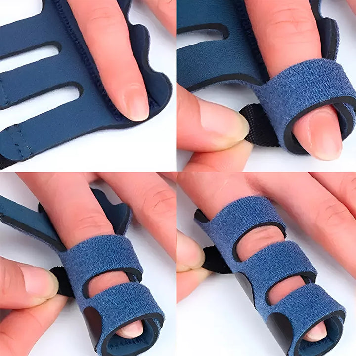 Trigger Finger Spalk Verstelbare Ondersteuningsbrace